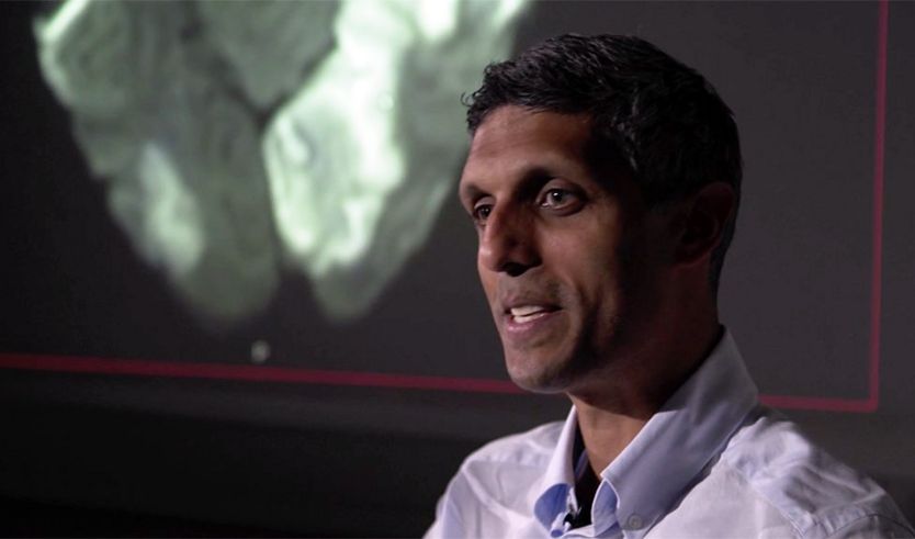 Dokter spesialis neurologi Arvind Chandratheva dengan gambar scan otak di belakangnya.