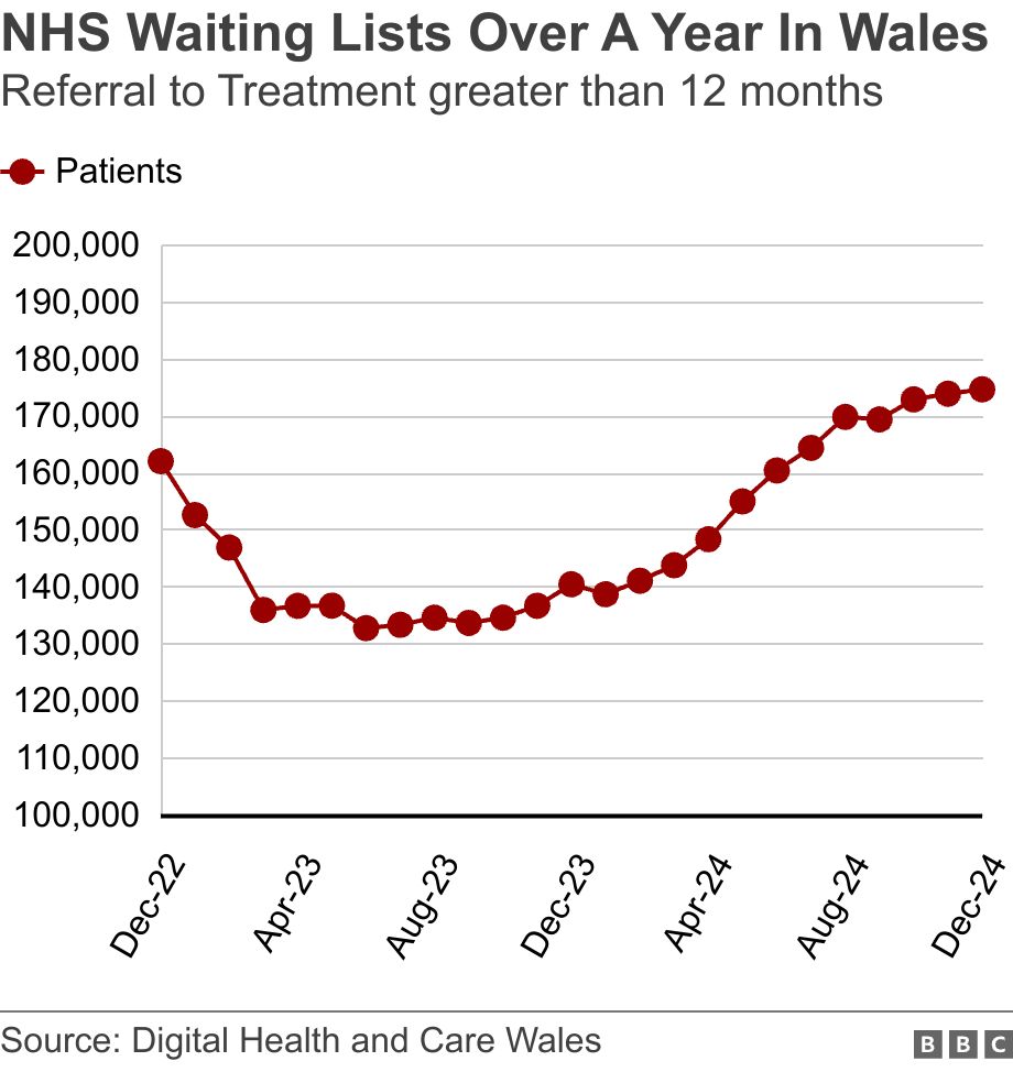 NHS Waiting Lists Over  A Year In Wales. Referral to Treatment greater than 12 months. Line graph over time between December 2022 and December 2024 showing the number of NHS patients in Wales waiting over a year for referral to treatment, with 161,935 patients in December 2022, falling to 132,616 in June 2023, then steadily rising to stand at 174,541patients in December 2024 .