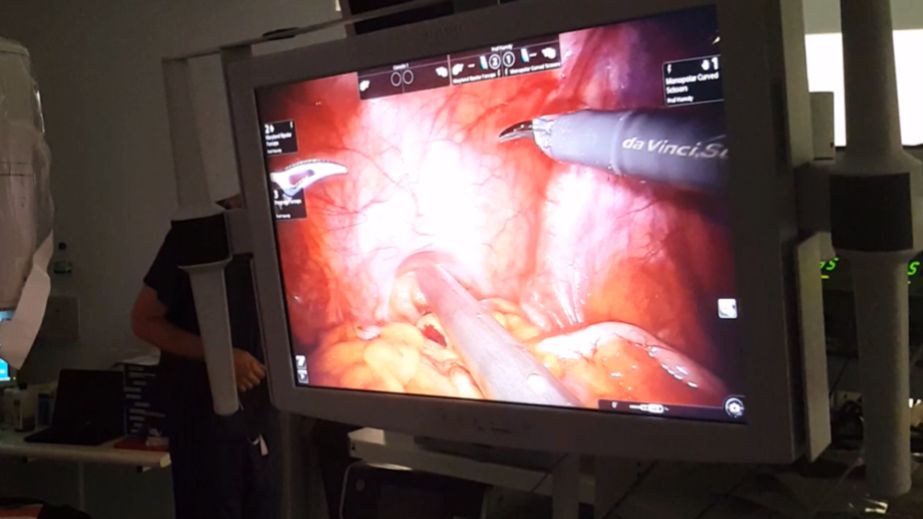 Imaging equipment and dye being used in prostate cancer surgery
