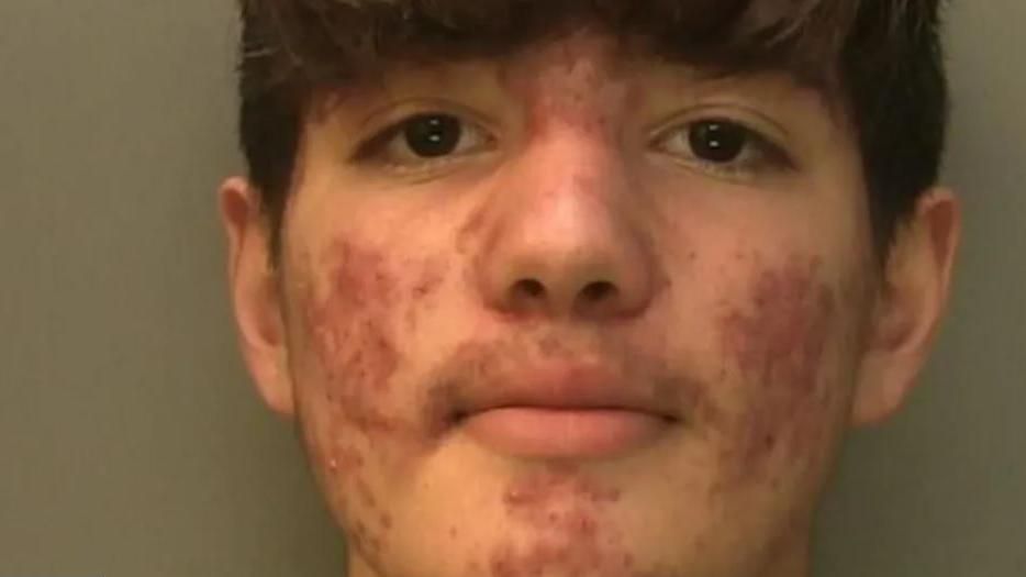 A 16 year old boy with short dark hair, dark eyes and an acne-scarred face stares directly at the camera in a police mugshot. 