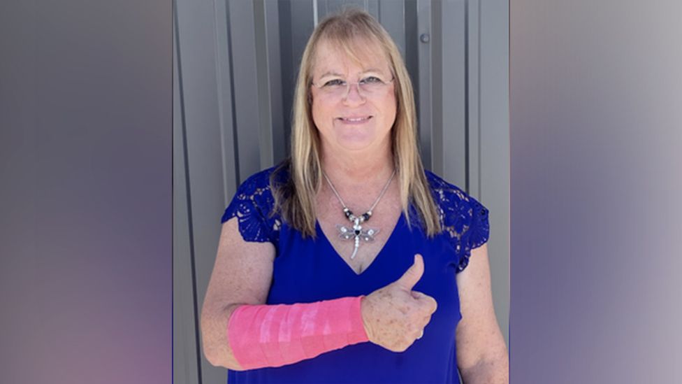 The victim with a cast on her arm