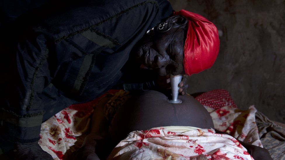 Angelina Akuec a traditional birth attendant listens to the heartbeat of Mary Adau's baby