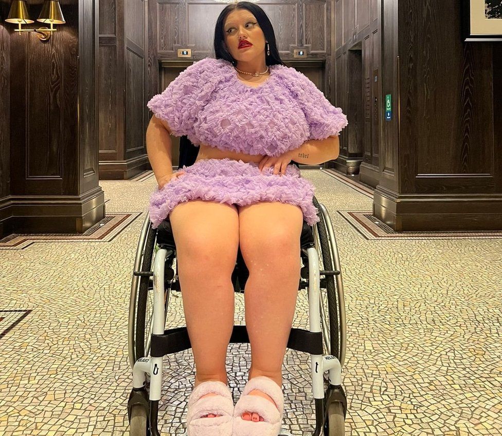 Instagram and TikTok star Were not used to seeing disabled people as sexy 
