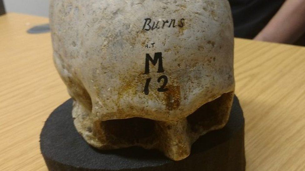 The cast of Robert Burns skull