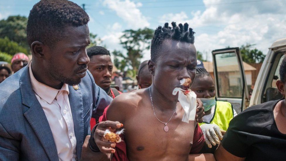 Ugandan musician-turned-politician Robert Kyagulanyi, also known as Bobi Wine (L), helps his producer Dan Magic (R) into a hospital in Kayunga, Uganda, on December 1, 2020