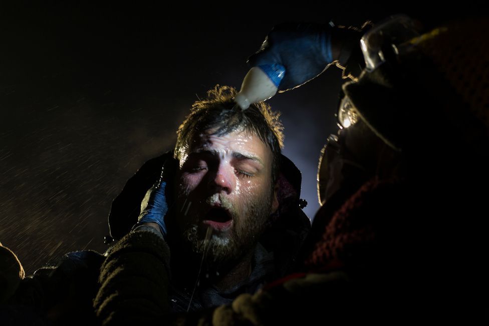 A man is treated with milk of magnesia after being pepper sprayed at the police blockade on highway 1806 near Cannon Ball, North Dakota Sunday, 20 November 2016