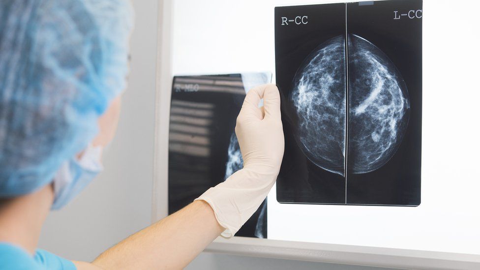 Doctor holds up a mammogram in front of an x-ray illuminator