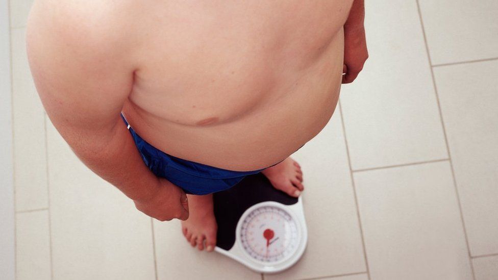 An overweight child stands on scales