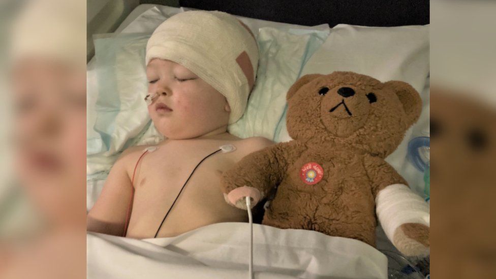 4 year old Artie lying in a hospital bed with his eyes closed beside a brown teddy bear. Artie has bandages around his head and tubes up his nose.