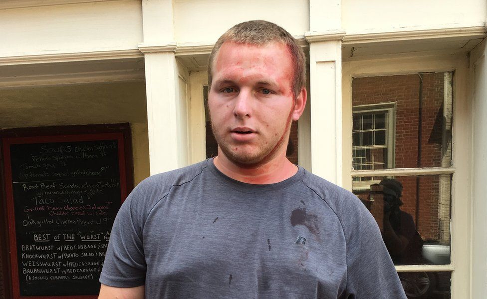 Daryl Vaughan, 24, was surrounded and beaten by counter-protesters