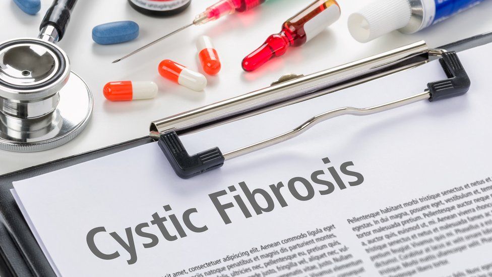 Cystic fibrosis diagnosis