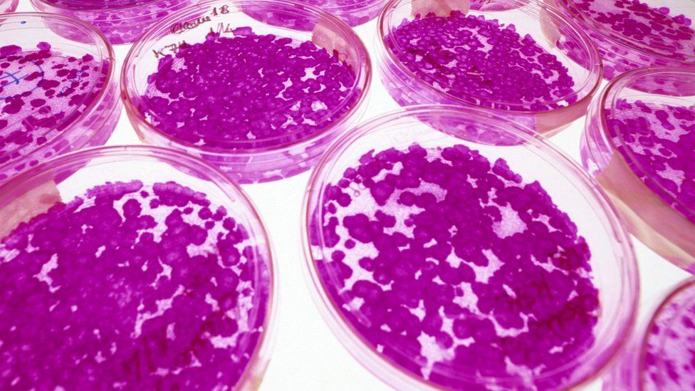 stem cells in petri dishes