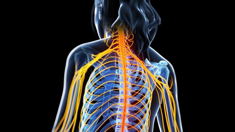 illustration of MS attacking the spinal cord