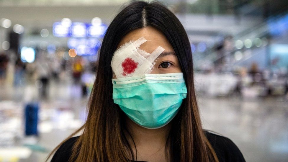A protester wears a mock eye patch as protesters occupy Hong Kong International Airport in Hong Kong, China, on 13 August 2019
