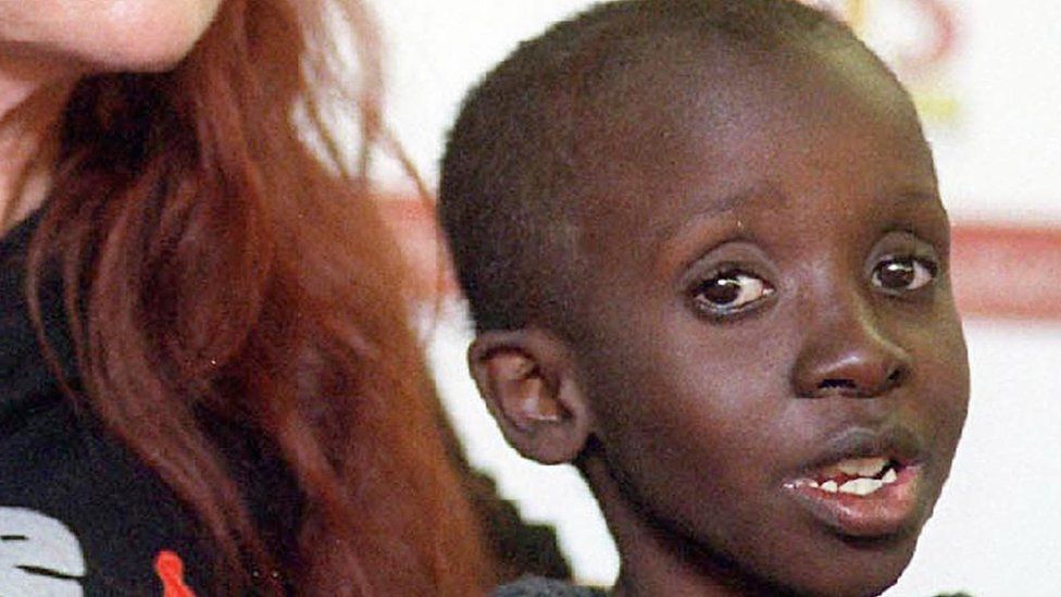 Nkosi Johnson at 11-years-old