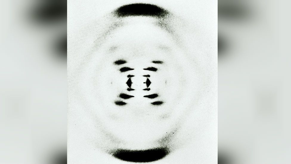 DNA X-ray photograph