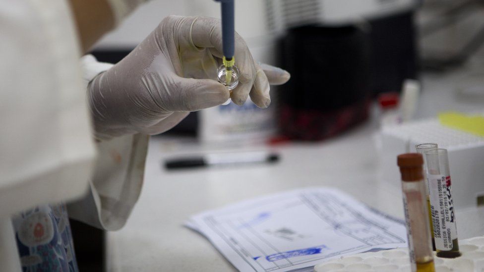 Blood samples being analysed in Guatemala City