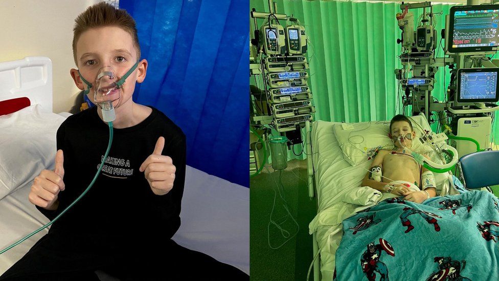 A split image showing an otherwise healthy looking boy with brown eyes and blonde hair wearing an oxygen mask and an image of the same boy very sick in a hospital bed hooked up to multiple screens and tubes