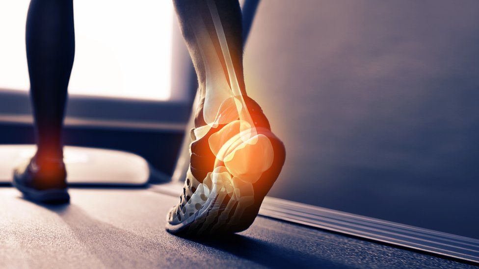 A runner with a foot injury