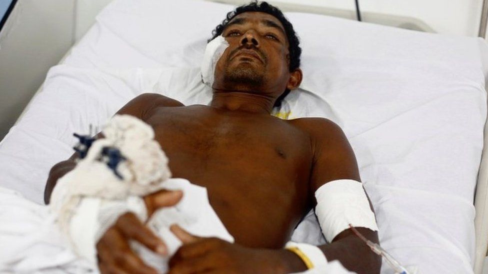 Jose Ribamar from Brazil's indigenous Gamela tribe at a hospital after he was injured in a dispute over land in in Sao Luis, Maranhao state, Brazil, May 2, 2017