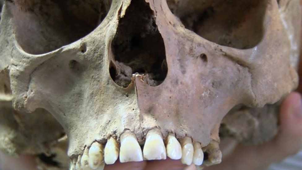 Skull of Richard de W'Peton