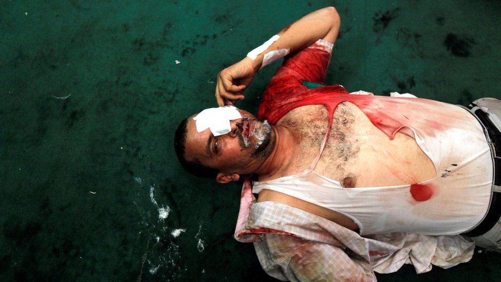 An injured supporter of Mohammed Morsi lies inside a mosque in Ramses Square, Cairo, Egypt (16 August 2013)