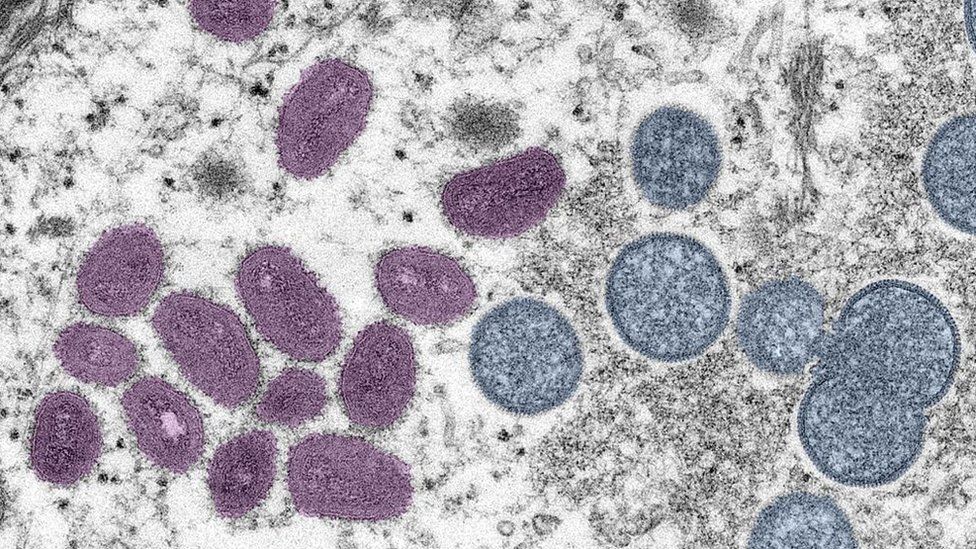 На изображении показаны частицы вируса оспы обезьян