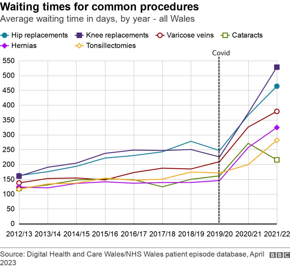 NHS Wales Swansea tops hospital waiting lists for knees, hips BBC News