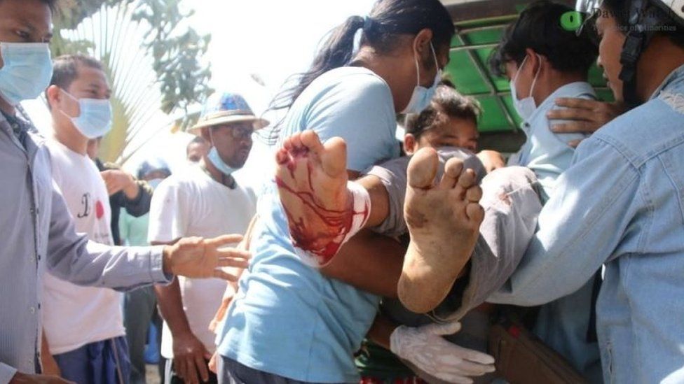 Medical staff carry away a wounded protester in Dawei