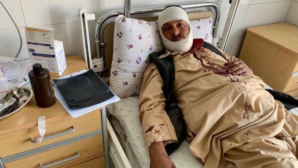 Man injured in blast at Afghan election rally, 17 September 2019