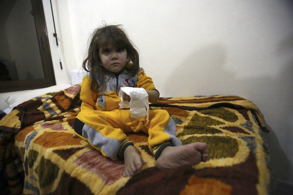 An injured girl from east Aleppo sits in a hospital bed near Idlib, 16 December