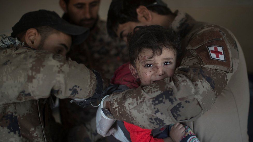 A boy injured by an IS car bomb during fighting in Mosul is treated at an Iraqi military field hospital (25 November 2016)