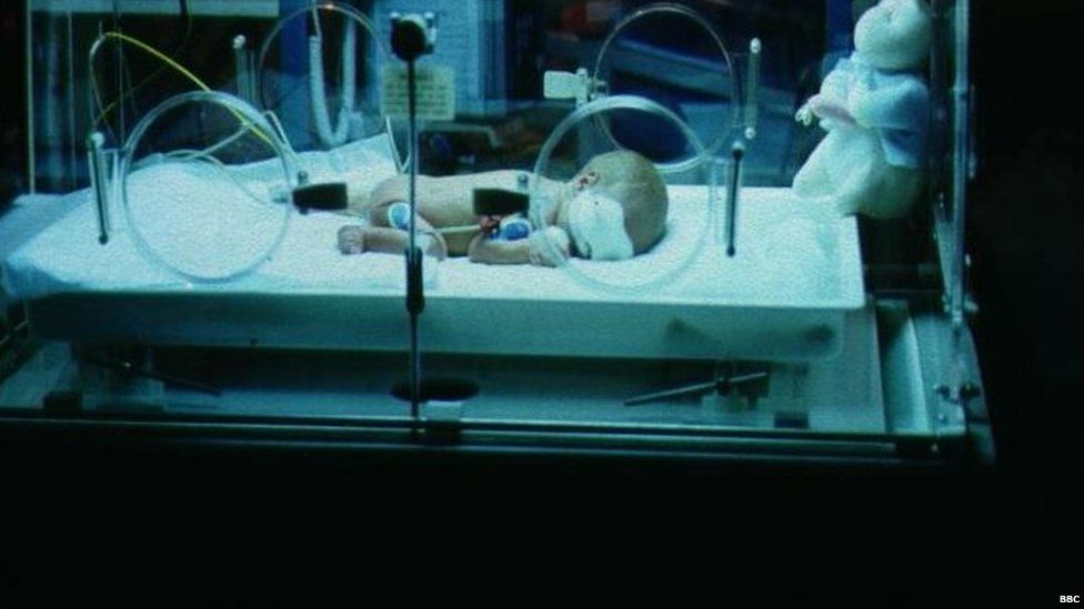 Incubator baby pre-1993