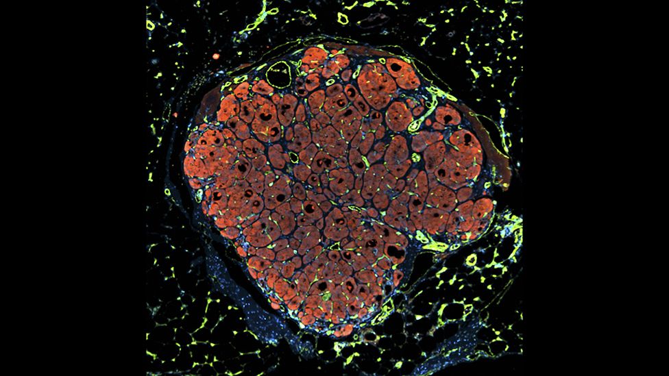 Engineering human liver tissue - Chelsea Fortin, Kelly Stevens and Sangeeta Bhatia, Koch Institute, MIT
