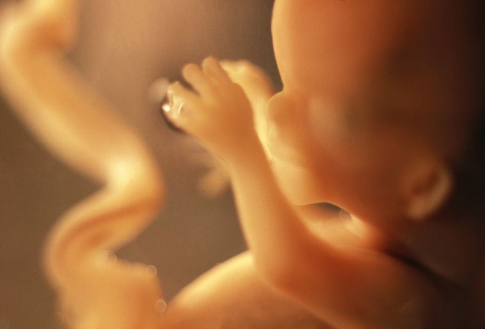 Foetus at 12 weeks