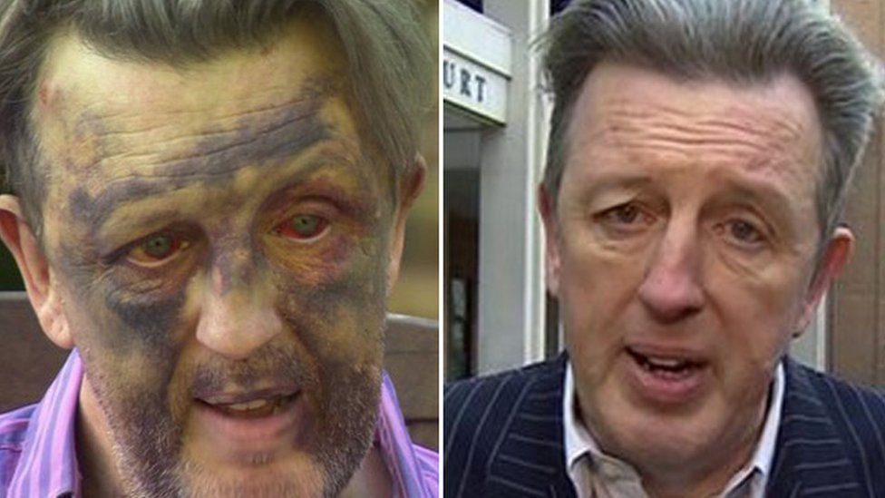 Paul Kohler soon after the attack (left), and outside court (right)