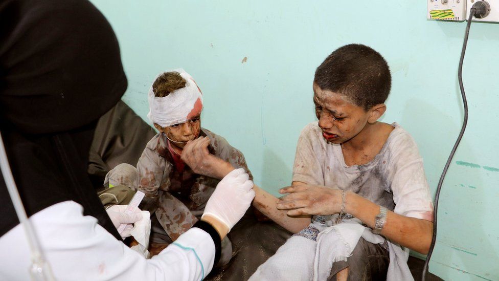 A doctor treats children injured by an air strike in Saada, Yemen (9 August 2018)