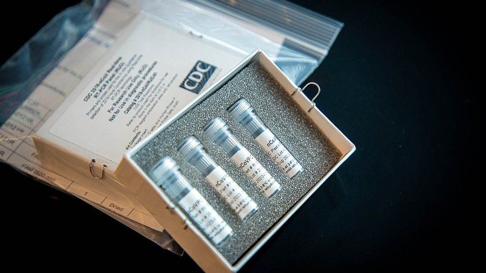 A Coronavirus laboratory test kit