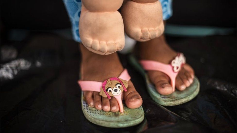 A migrant child in her flip-flops.