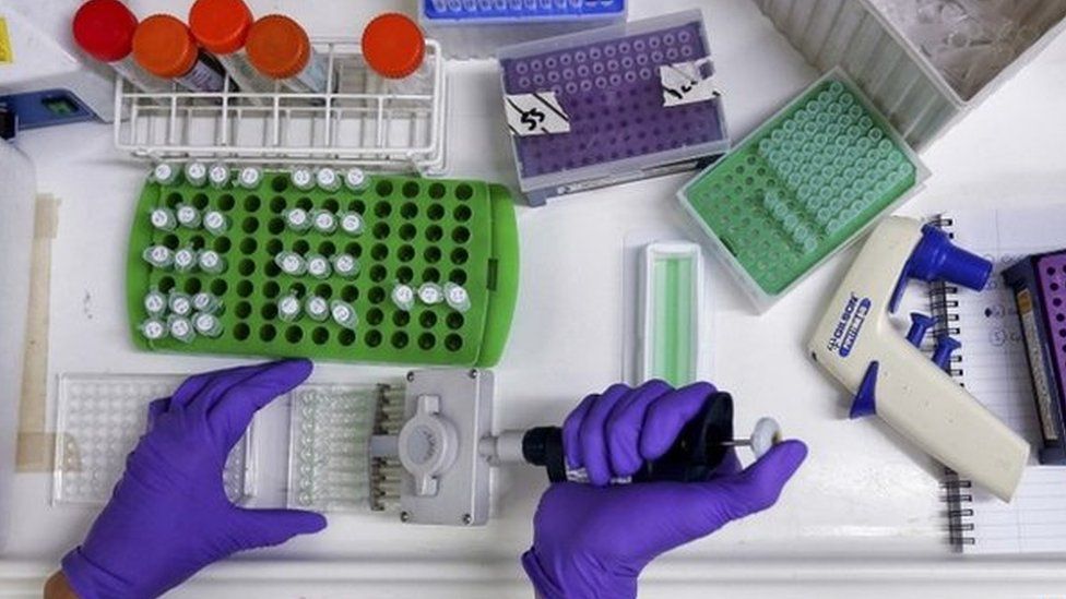 A scientist prepares protein samples for analysis in a lab
