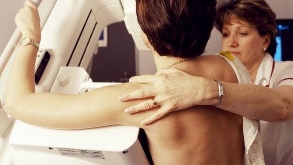 Breast cancer screening involves mammogram scans