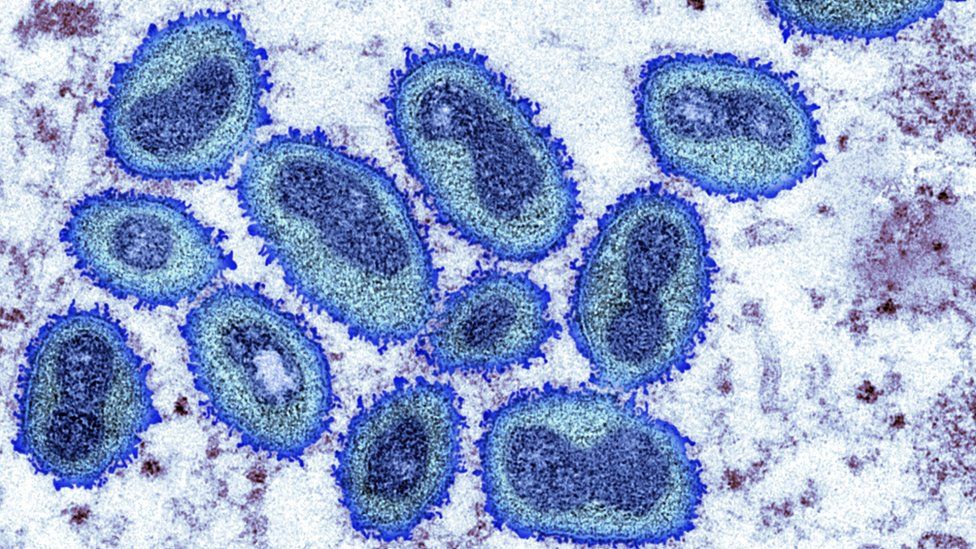 Monkeypox under a microscope