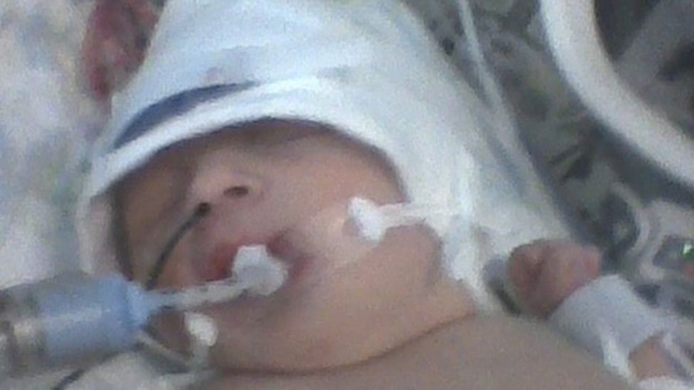 Royal Oldham Hospital admits baby forceps death BBC News