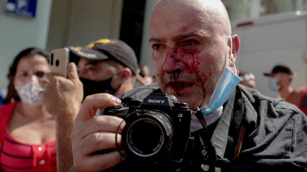 AP photographer, Spanish Ramon Espinosa, is seen with injuries in his face