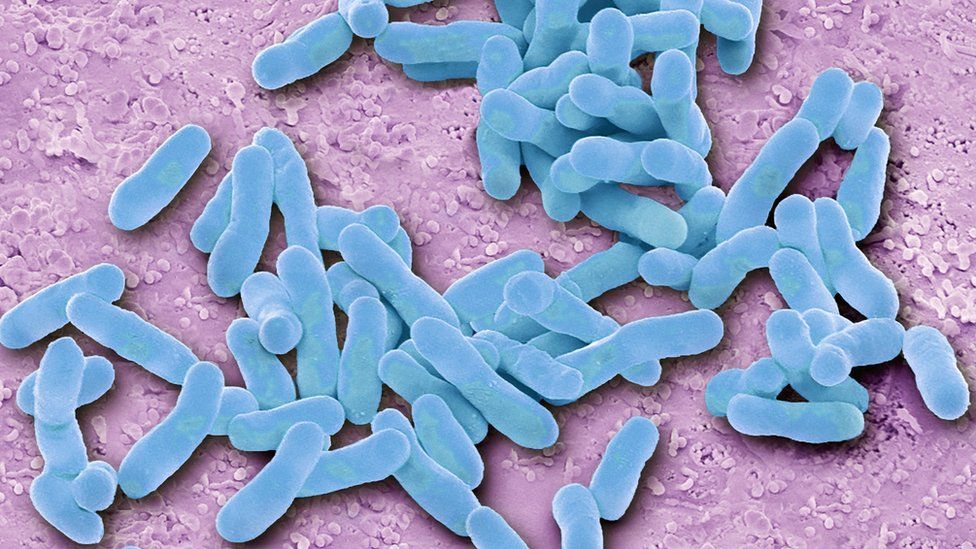 'War on superbugs' like E. coli announced by government - BBC News