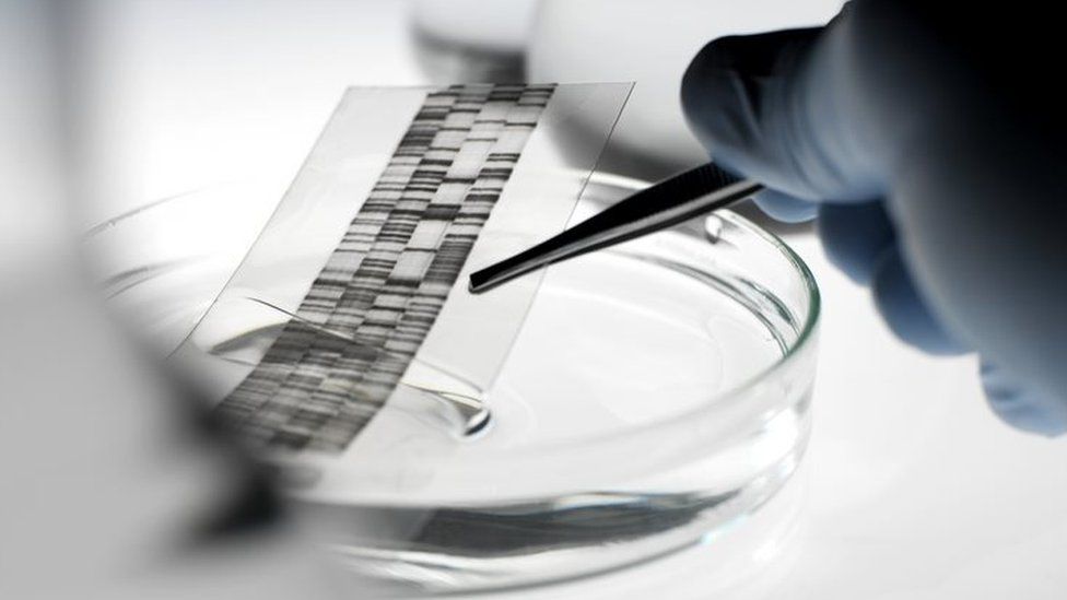 DNA autoradiogram being picked up with a pair of tweezers from a petri dish