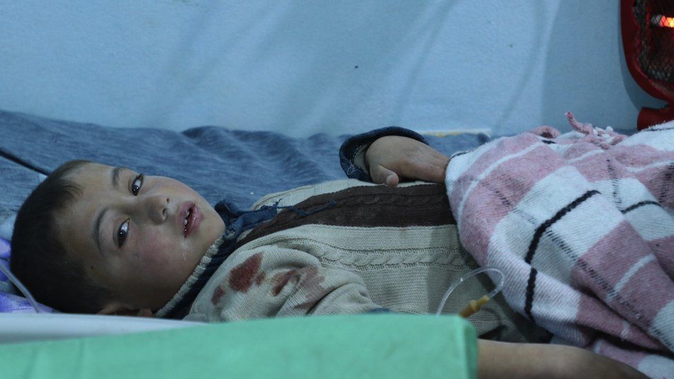 Маленькому мальчику оказывают медицинскую помощь в больнице SAMS на севере Сирии