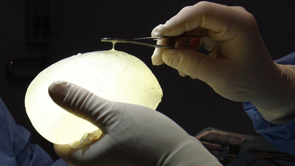 Defective silicone gel breast implant made by PIP - 2011 file pic
