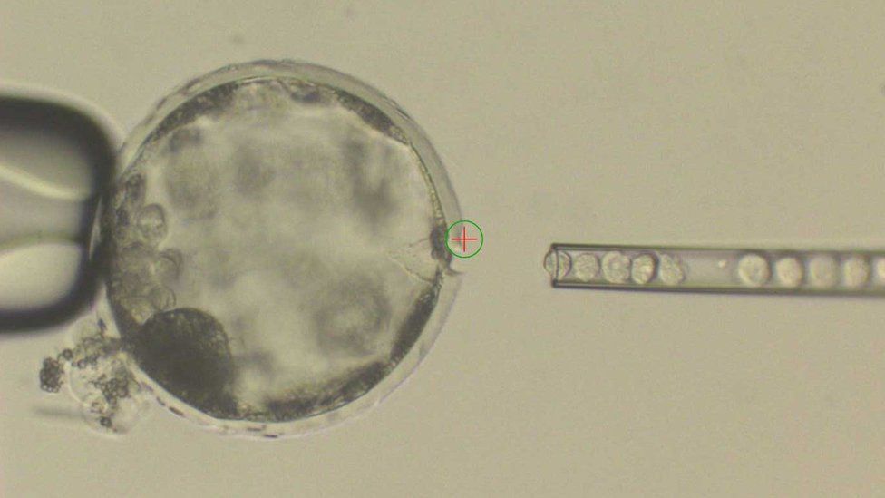 Human cells injected into a pig embryo