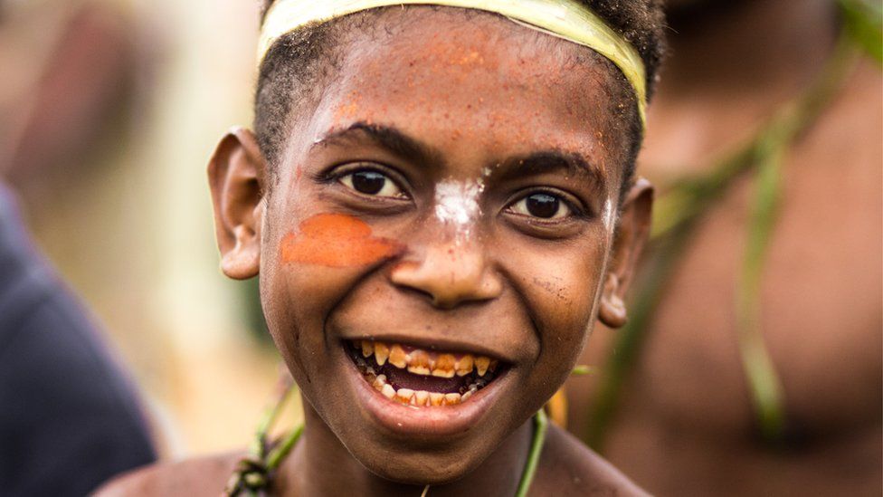 Young boy with betel nut stained teeth